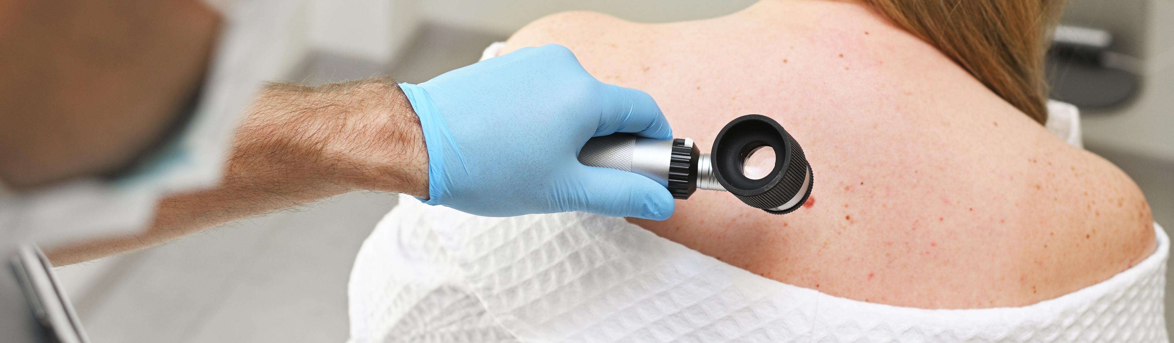 Dermatoskopia 1