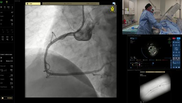 From Metal to Nothing Left Behind: nowoczesne strategie PCI