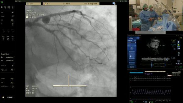 Tętniaki tętnic wieńcowych – od diagnostyki do bezpiecznego wykonania PCI